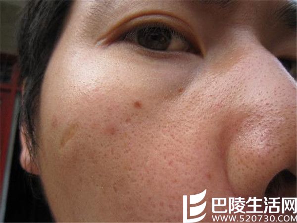 p9741131.jpg p9741131.jpg