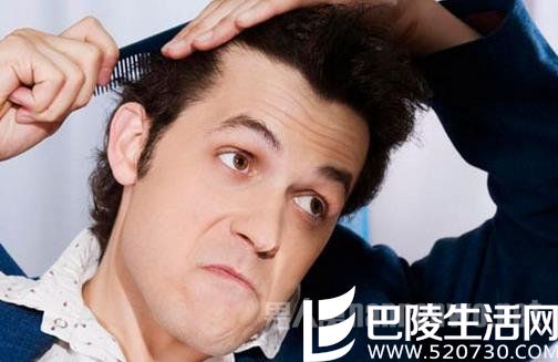 男士脱发治疗 男士脱发治疗