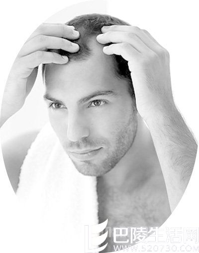 脱发的原因 脱发的原因