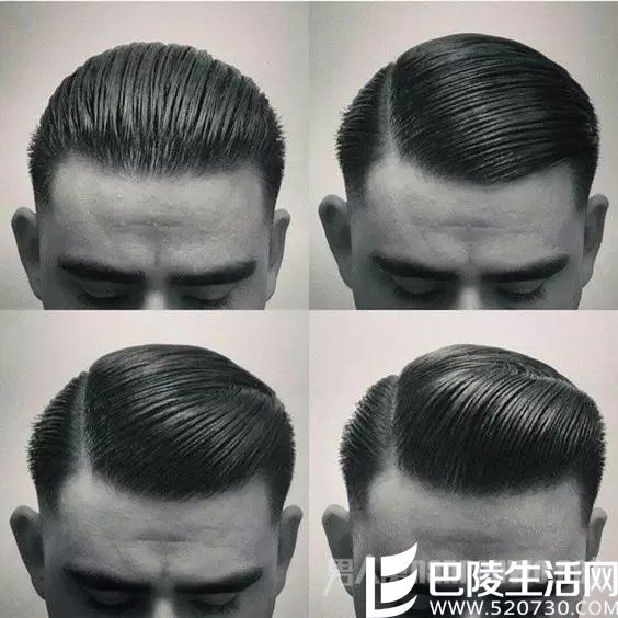 侧分油头 侧分油头