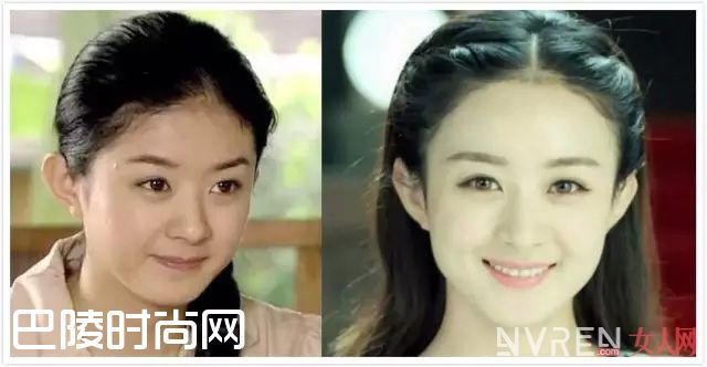 发际线低怎么办_发际线太高太丑怎么办?戳进来我教你 发际线低怎么办_发际线太高太丑怎么办?戳进来我教你