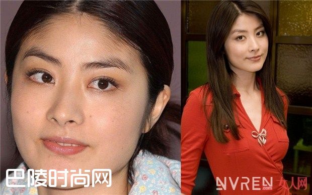 发际线低怎么办_发际线太高太丑怎么办?戳进来我教你 发际线低怎么办_发际线太高太丑怎么办?戳进来我教你