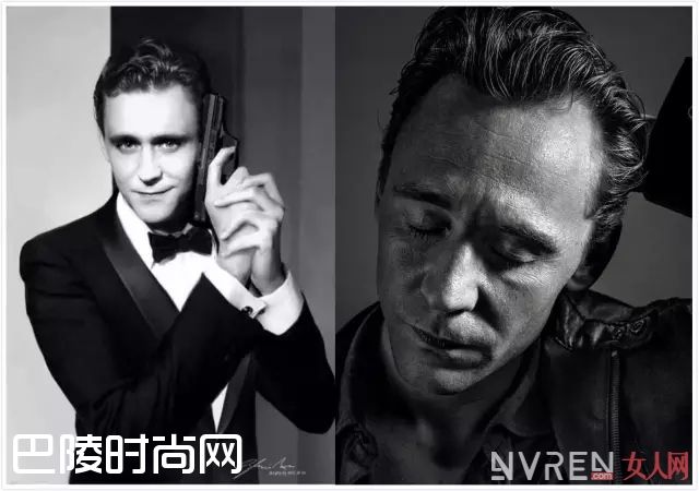 发际线后退_发际线太高太丑怎么办?戳进来我们教你