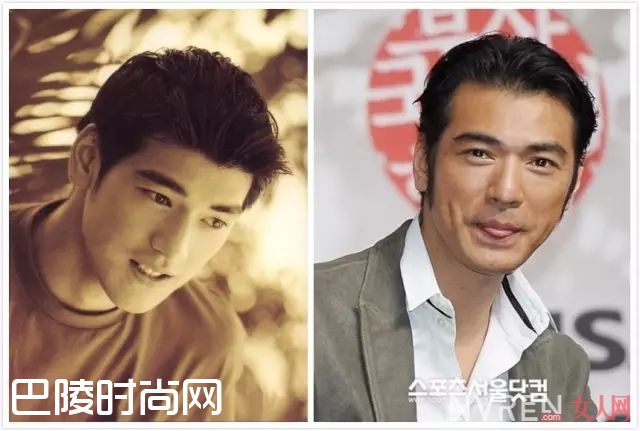 发际线后退_发际线太高太丑怎么办?戳进来我们教你