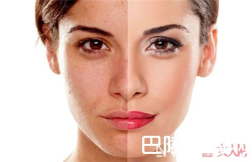 去角质需要注意什么事项_ 去角质的诀窍有哪些 不同类型不同去角质的方法