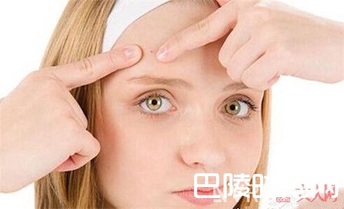额头发际附近为什么会长痘_额头长痘的主要原因有哪些 盘点六个额头长痘痘的元凶