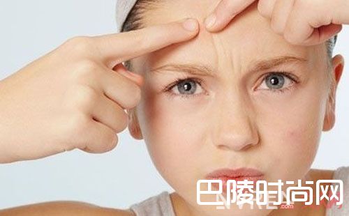 额头上长痘痘是什么原因_额头长痘的主要原因有哪些 盘点六个额头长痘痘的元凶