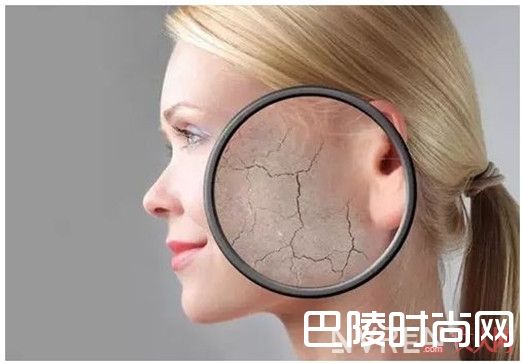 干性皮肤的原因和特征_干性皮肤怎么保养 滋养干性皮肤的食物介绍