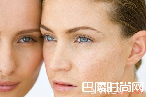 脸上长斑是什么原因导致_脸上长斑是什么原因？如何正确祛斑？