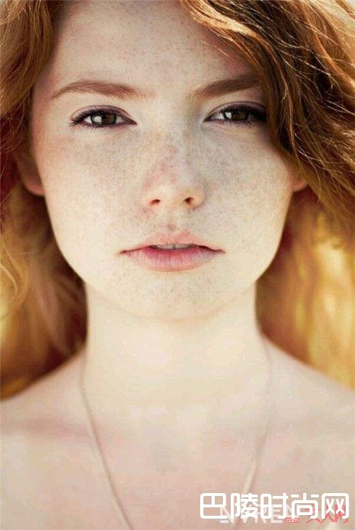 什么斑可以祛除_如何才能治疗你脸上的斑斑锈迹？主要还是得根治