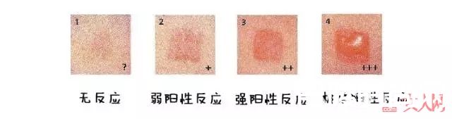 脱毛膏如何使用有什么优缺点_夏季脱毛大作战 15款超级好用又不伤皮肤的脱毛产品推荐