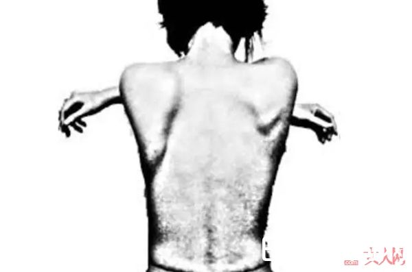 脖子前倾怎么办_教你做颈部护理 怎样才能有迷死人的天鹅颈？