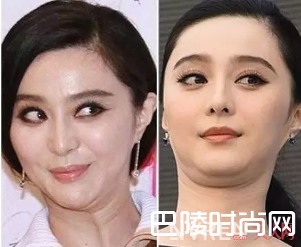 有颈纹怎么办_教你做颈部护理 怎样才能有迷死人的天鹅颈?