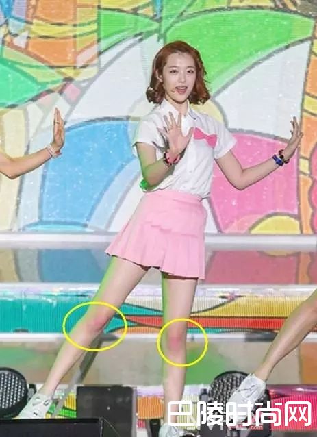 如何美化膝盖_夏日露肉学习班开课了 露出的每一个部位都有学问