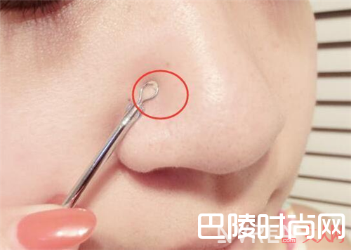 鼻子边挤出白色小颗粒是什么_鼻子边挤出来白色的小颗粒居然是黑头？那就把它扼杀了