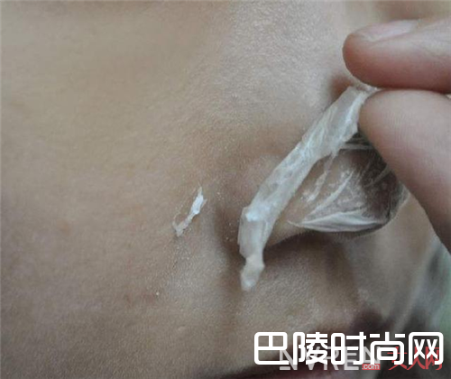 如何有效去除黑头_鼻子边挤出来白色的小颗粒居然是黑头？那就把它扼杀了