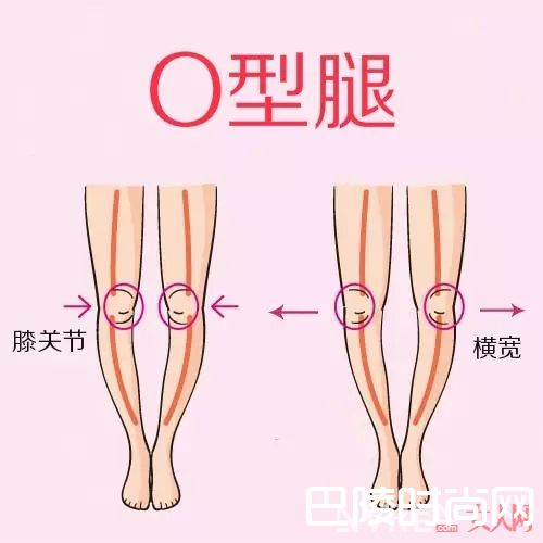 O形腿如何选择裙子?_又到了露腿的季节 你知道如何根据腿型选裙子吗?