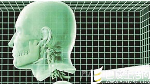 世界首例人体换头术4大释疑