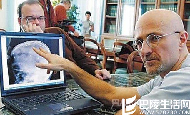 世界首例人体换头术争议 世界首例人体换头术争议