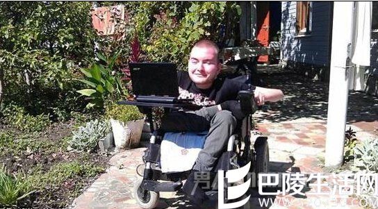 世界首例人体换头术