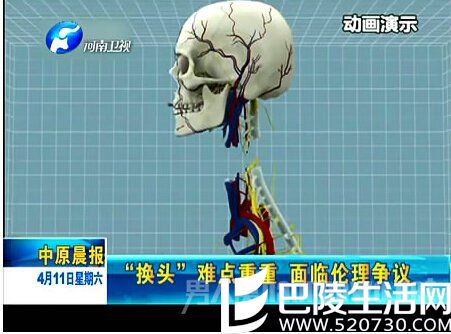 人体换头术靠谱吗