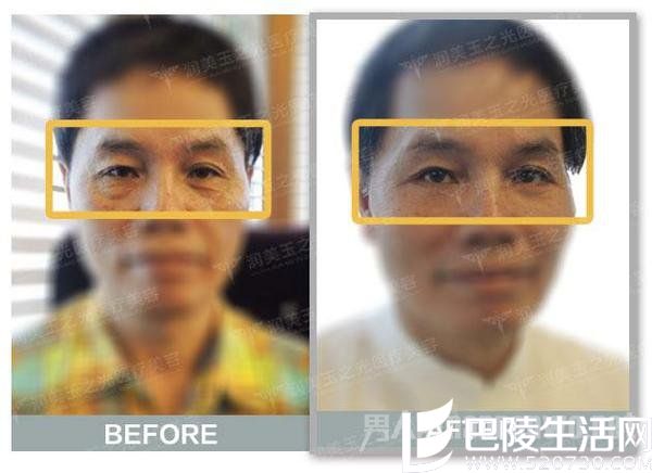 一次治疗让你比同龄人年轻十岁