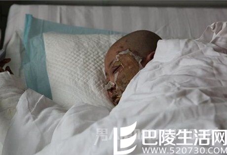 不治身亡