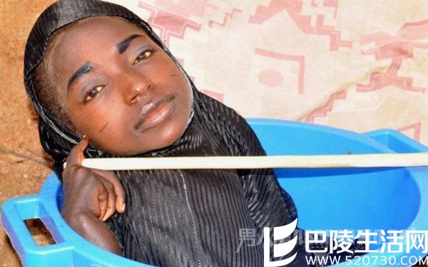 女孩因怪病仅剩头部