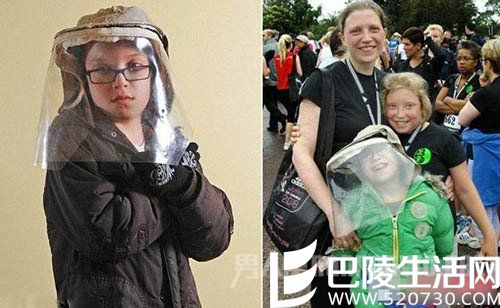 色素性皮肤干燥症