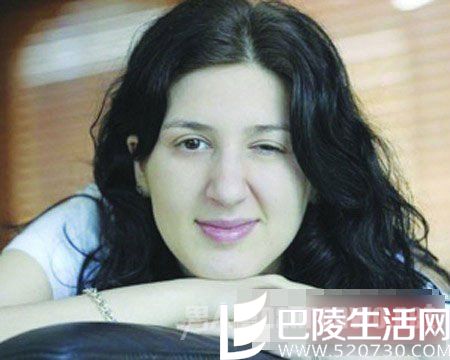 间歇性眼皮瘫痪