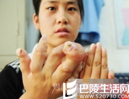 全身骨头都在生长的女子