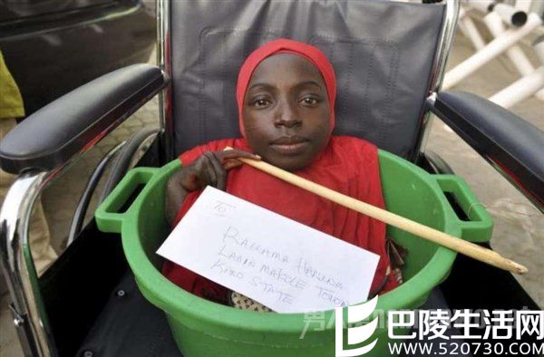 女孩得怪病只剩下头部