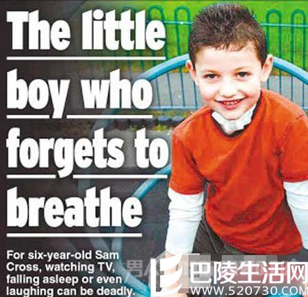 中枢换气不足综合征