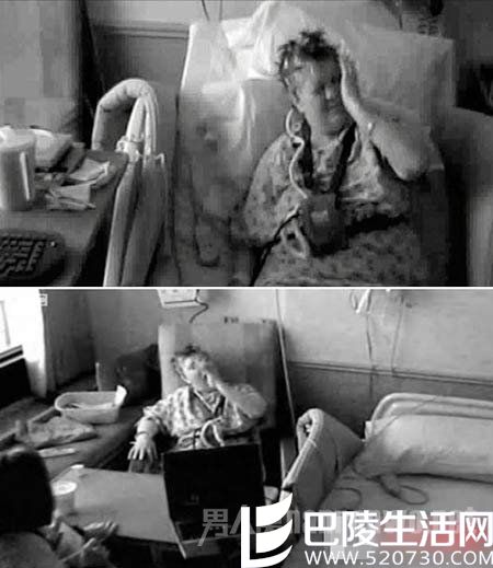 异己手症候群 异己手症候群