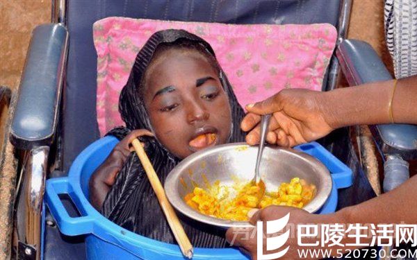 女孩因怪病仅剩头部