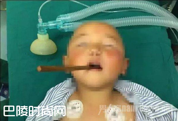 筷子插进女孩嘴里入脑4厘米