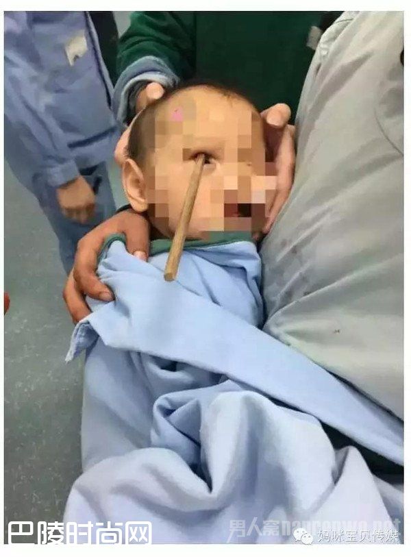 春节熊孩子受伤案例