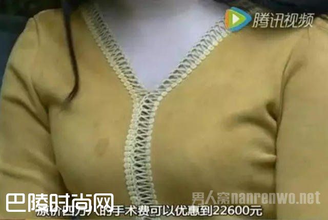 隆胸没做成 隆胸没做成