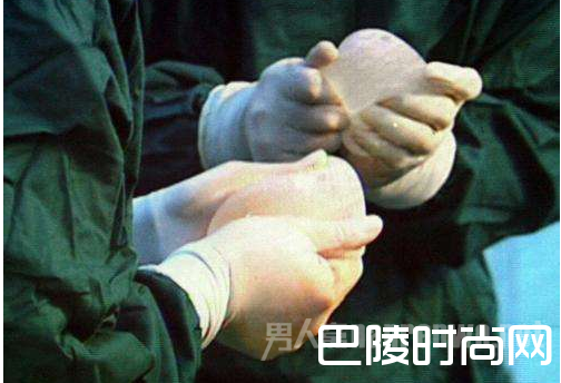 老汉做变性手术