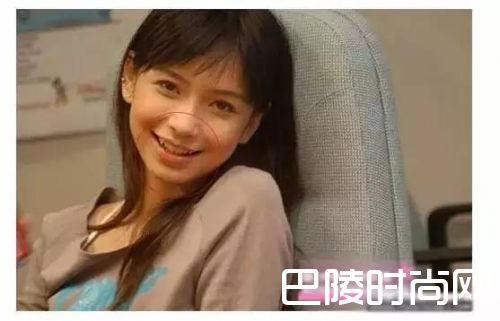 baby旧照学生时期照片 angelababy整容了吗（4）