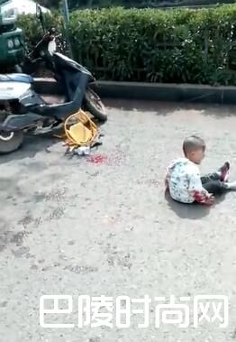 2岁孙子伤情严重