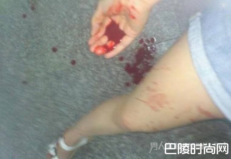 将男生刺伤 将男生刺伤