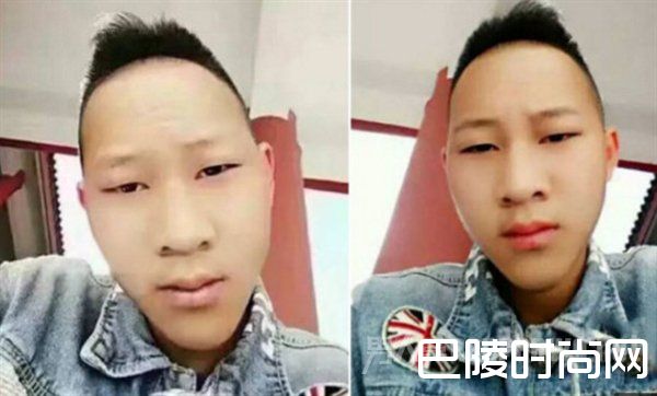 男子击败全国脑型照片