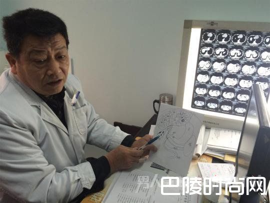 聂继光通过绘图方式向患者讲解病情