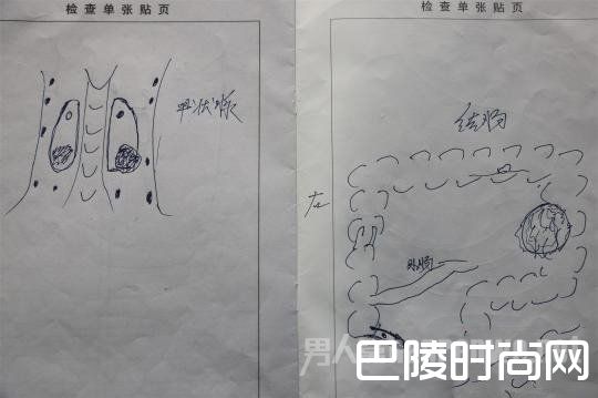 聂继光绘就的病情图纸