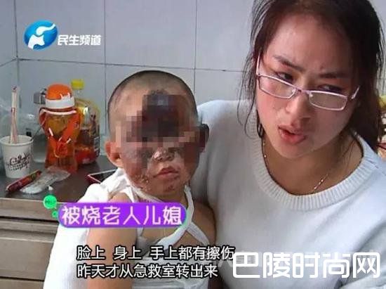 被烧老人儿媳