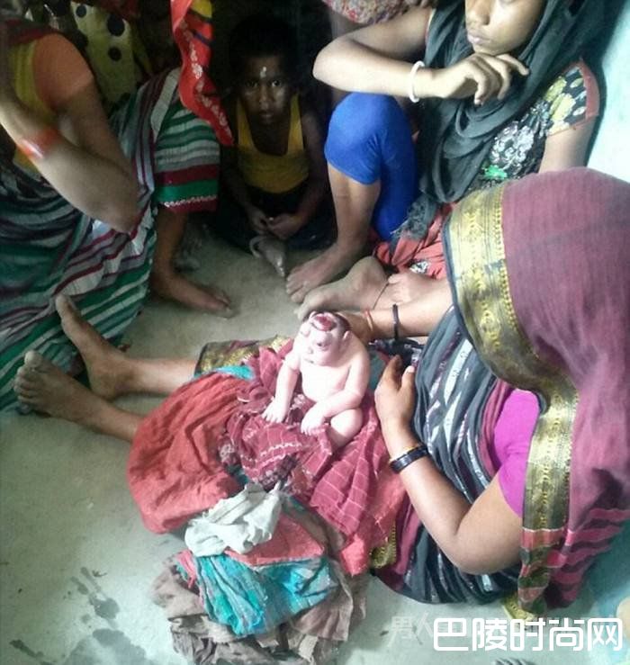 印女子生下怪婴