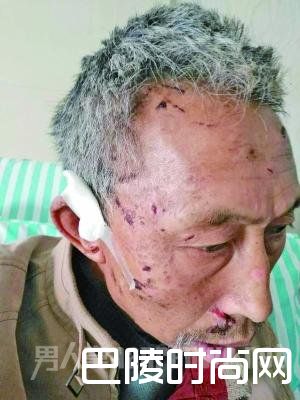 老人受伤 老人受伤