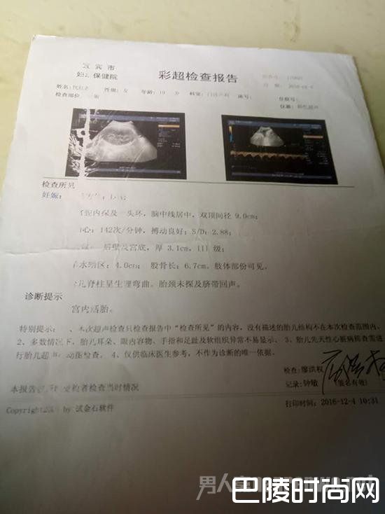 彩超检查报告中,并未明示形体发育情况 彩超检查报告中,并未明示形体发育情况