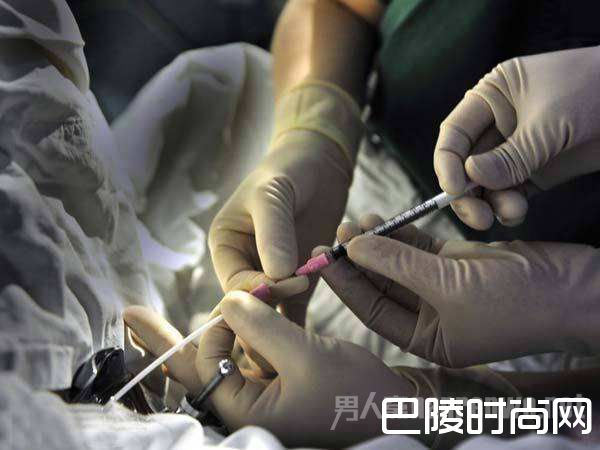 试管婴儿 试管婴儿